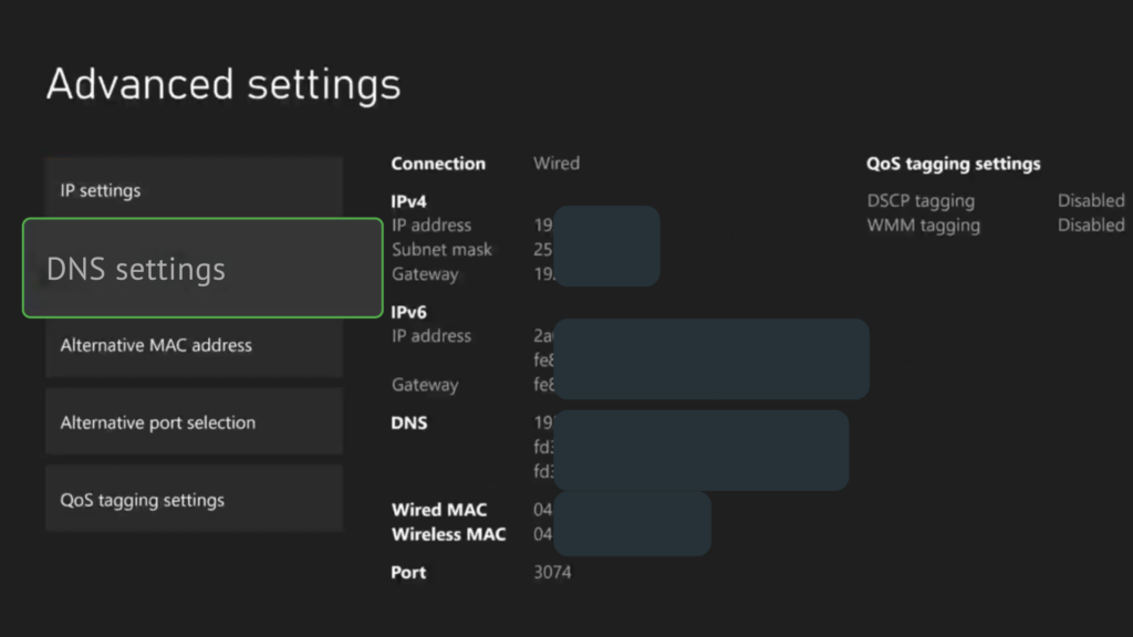 Xbox DNS Settings screen with the “Manual” option selected to configure IPv4 DNS manually.